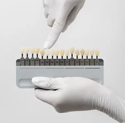 The Role of Porcelain Veneers in Modern Smile Transformations